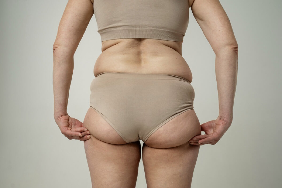 How to Lose Pockets of Fat Non-Invasively and Safely in Sydney